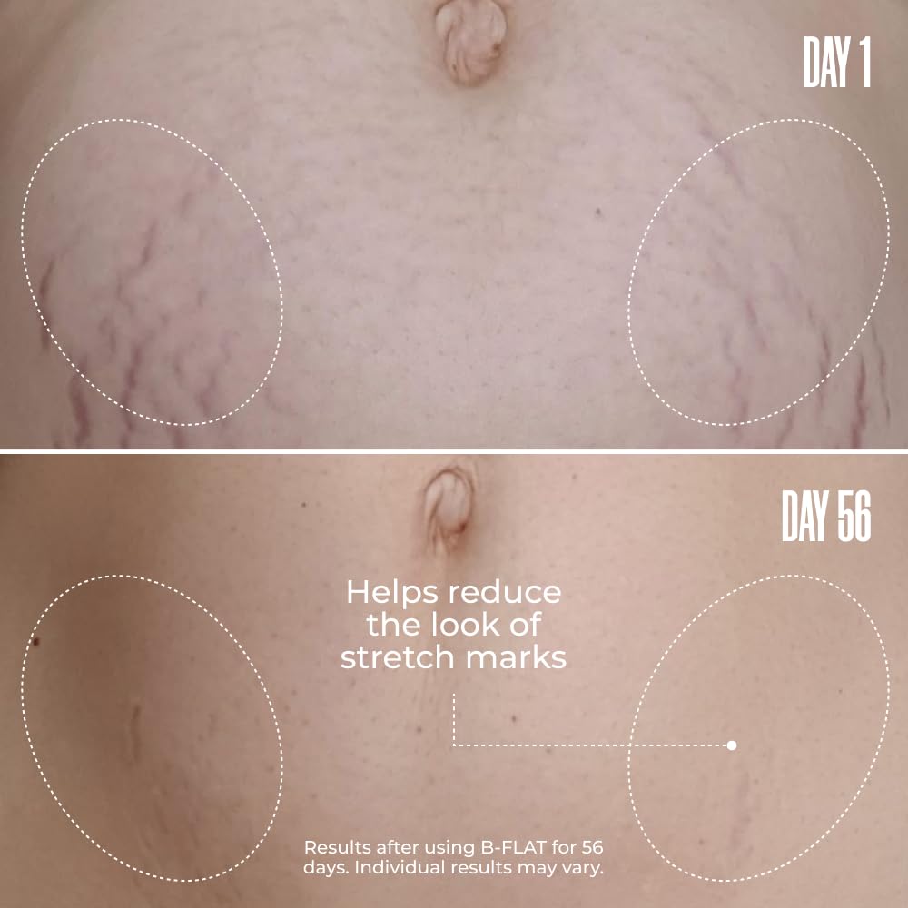 B-FLAT Belly Firming Cream