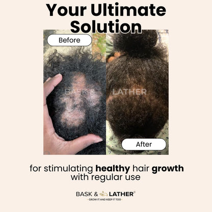 Scalp Stimulator Hair Growth Oil