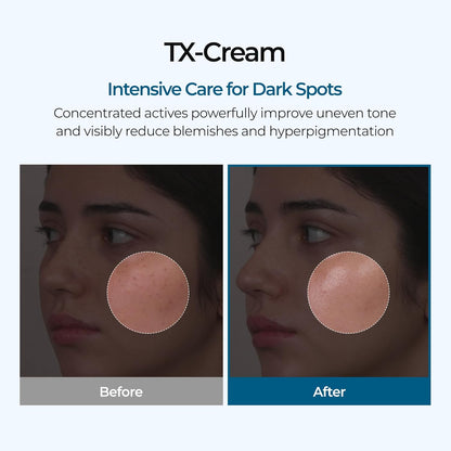 TX Tranexamic Acid Cream
