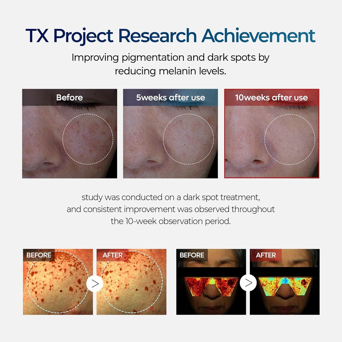 TX Tranexamic Acid Cream