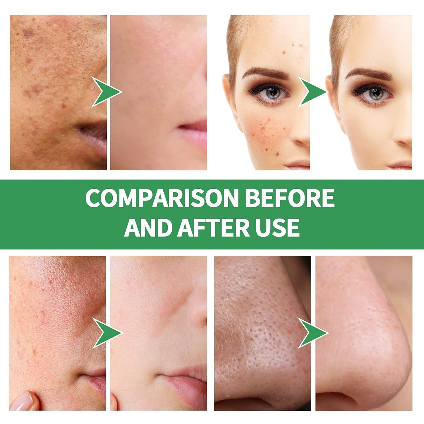 Centella Asiatica Bubble Facial Mask