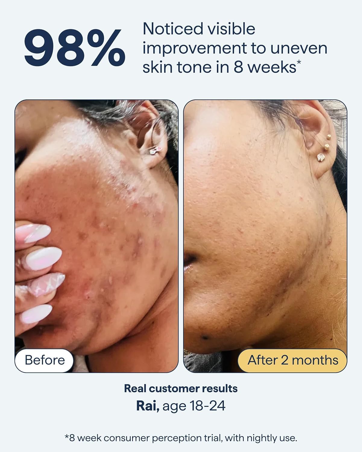 Remedy for Dark Spots