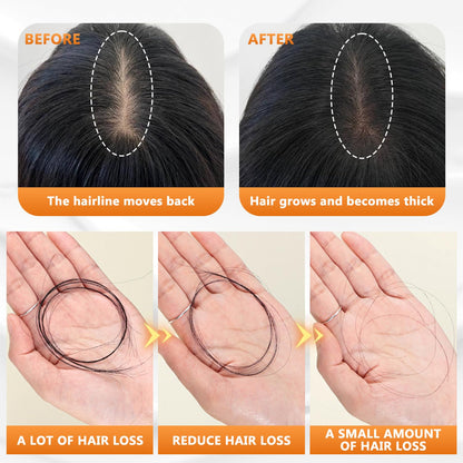 Anti-Hair Fall Shampoo