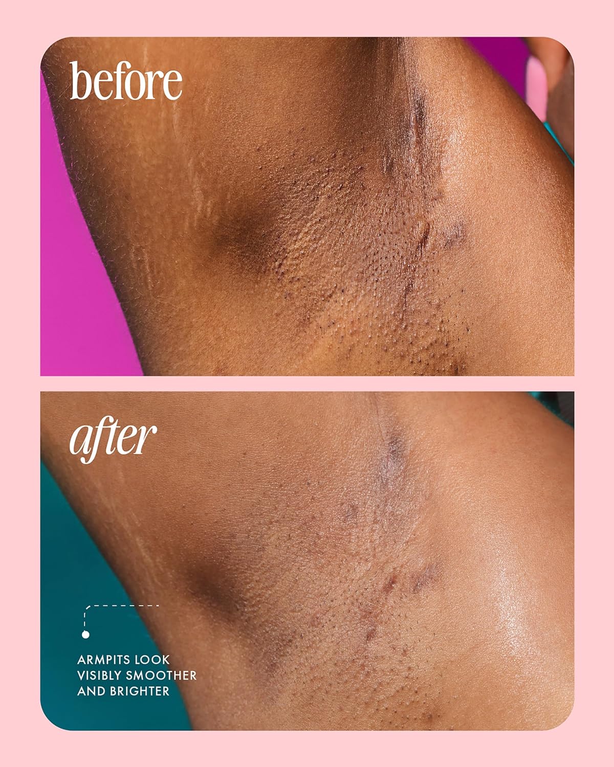 Truly Beauty Unicorn Fruit Deodorant